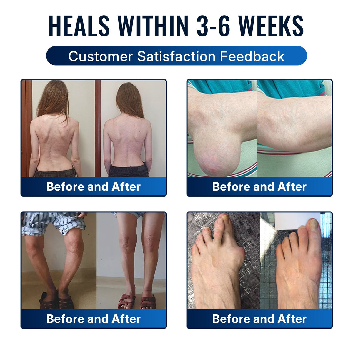 🎁Healrize® Bee Venom Joint Relief Cream 💞Targets stiff, sore joints in knees, hands, shoulders, back & more — so you can move easier every day